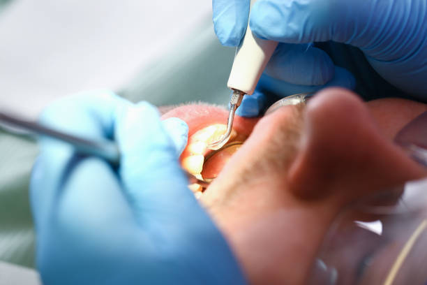 Best Tooth Pain Emergency Relief  in Oblong, IL