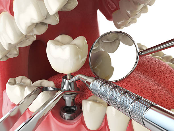 Best Dentist for Tooth Abscess  in Oblong, IL